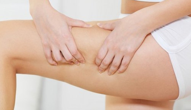 Cellulite Pack.weddingplz